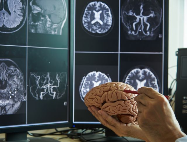 Прием невролога